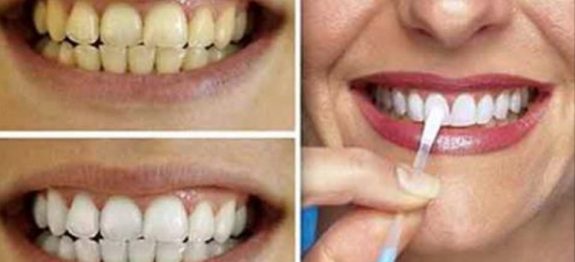 dentes_-_babosa (1)