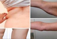 exercicio_-_bracos_e_costas_ed