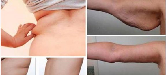 exercicio_-_bracos_e_costas_ed