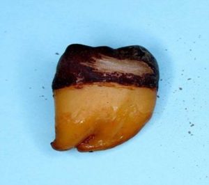 large_efeito_dente-min