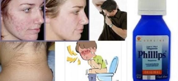 leite_de_magnesia_-_novo_edit