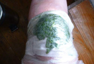 repolho_-_dor_nos_joelhos