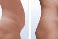 7bfdaed7749b580c877d02649e8135b5 (1)