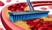 arterias_-_colesterol_-_novo
