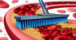 arterias_-_colesterol_-_novo