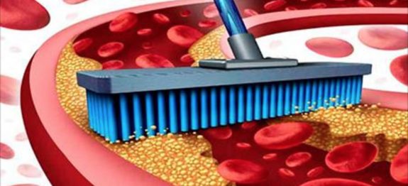 arterias_-_colesterol_-_novo