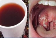 beterraba_-_garganta