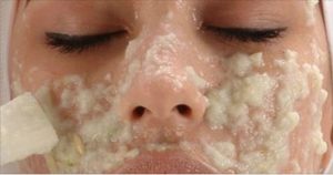 botox_caseiro