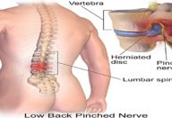 dor_nas_costas_-_exercicios