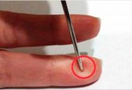 furo_-_agulha_-_avc