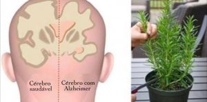 plantas_-_alzheimer