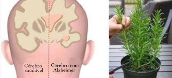 plantas_-_alzheimer