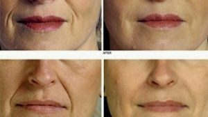 818aed2a1078791122ce7f71b1a736a7