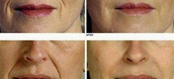 818aed2a1078791122ce7f71b1a736a7