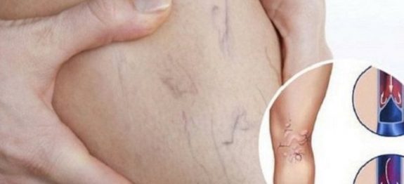 46d0b8c233844512d3684376aab8e79c