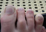 biotina_-_novo-610×300