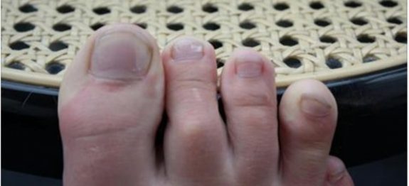 biotina_-_novo-610×300