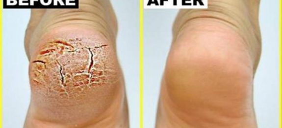 decb1633045e9b6def92539d4e173a63