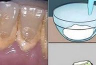 enxaguante_bucal-610×300