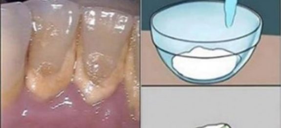 enxaguante_bucal-610×300