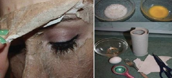 BOMBOU-NA-INTERNET-VEJA-COMO-ELIMINAR-ACNE-MANCHAS-E-PONTOS-NEGROS-COM-APENAS-2-INGREDIENTES-620×264