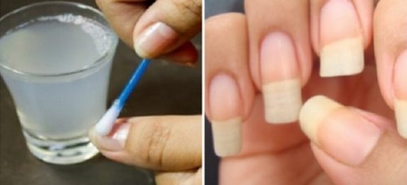 PARA QUE SUAS UNHAS CRESÇAM RÁPIDO E NUNCA SE QUEBREM- UM REMÉDIO SIMPLES COM APENAS 2 INGREDIENTES!