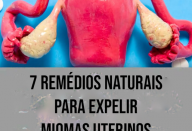7 remédios naturais para expelir miomas uterinos sem cirurgia…Ver mais