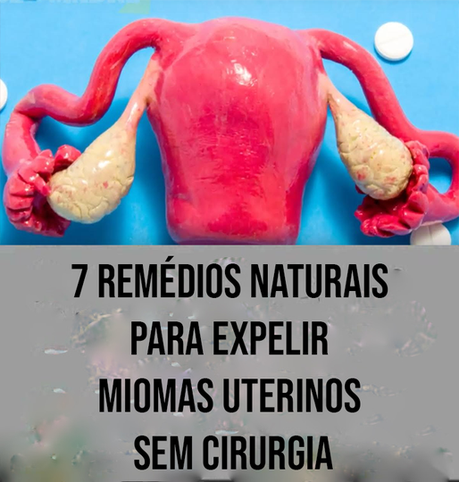 7 remédios naturais para expelir miomas uterinos sem cirurgia...Ver ...