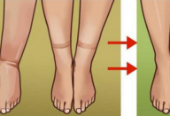 Chá especial para combater a retenção de líquido e ajudar a desobstruir as artérias