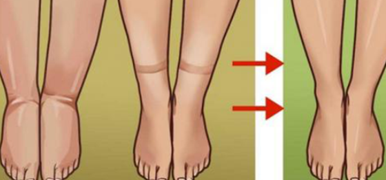 Chá especial para combater a retenção de líquido e ajudar a desobstruir as artérias