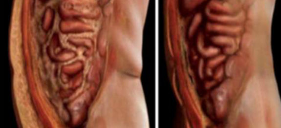 Esvazie o seu corpo de todos os vermes e parasitas – tome apenas 1 copo disto em jejum
