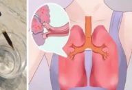 Tome 3 gotas deste óleo e dê adeus a alergias e a doenças respiratórias.. Ver mais