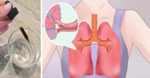 Tome 3 gotas deste óleo e dê adeus a alergias e a doenças respiratórias.. Ver mais