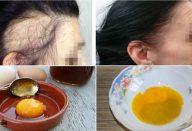 3 INGREDIENTES MÁGICOS – NUMA MESMA RECEITA – PARA SEU CABELO CRESCER MAIS RÁPIDO