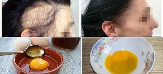 3 INGREDIENTES MÁGICOS – NUMA MESMA RECEITA – PARA SEU CABELO CRESCER MAIS RÁPIDO