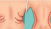7 exercícios eficientes para reduzir as gordurinhas nas costas e cintura em apenas 2 semanas.