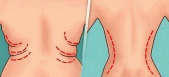 7 exercícios eficientes para reduzir as gordurinhas nas costas e cintura em apenas 2 semanas.