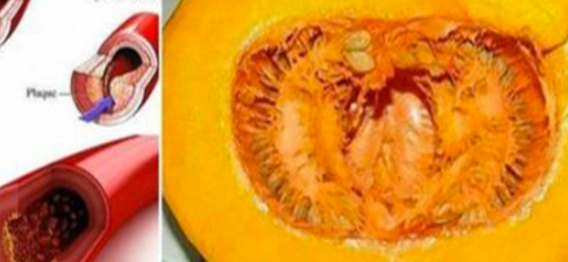 A receita que tem surpreendido até os médicos – apenas 1 abóbora para normalizar colesterol, triglicerídeos e glicose