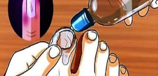 Use somente uma vez porque elimina os fungos muito rápido, dizem os especialistas