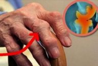 artrite_-_cloreto_de_magnesio_-_novo_-_padre_beno_edit