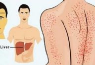 15 avisos que o corpo dá quando o fígado está sendo destruído.