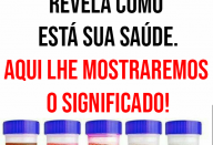 A cor da sua urina revela como está sua saúde. Aqui lhe mostraremos o significado.