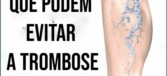 Consuma estes 7 alimentos que podem evitar a trombose.