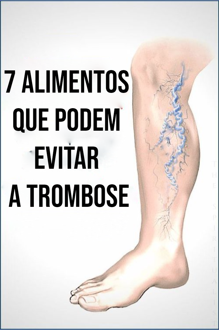 Consuma estes 7 alimentos que podem evitar a trombose. - Veja a Receita: