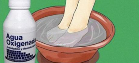 Elimine definitivamente os fungos das unhas dos pés e mãos com este remédio caseiro