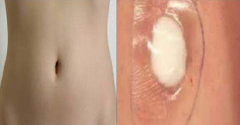 Gripe, tosse ou cólicas menstruais Basta colocar isto no umbigo e está resolvido