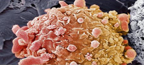 O câncer morre quando você come estes 10 alimentos. Consuma-os todos os dias!