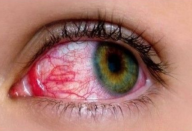 OLHOS