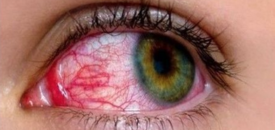 OLHOS