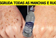 manchas